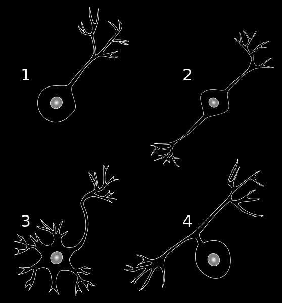 Gliaceller (stödjeceller) Vidare blodkärl, bindväv (hjärnhinnor, nervskidor) Nervceller (neuroner) Nervceller (neuroner) Funktion: Signaltransport