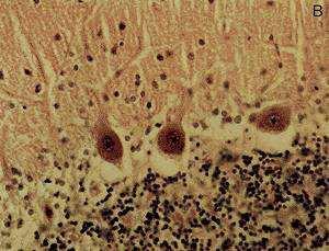 Nervceller (neuroner) Nervceller (neuroner) Stora Purkinjeceller och små kornceller i lillhjärnan