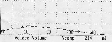 50 ml/s 10 Urodynamiska