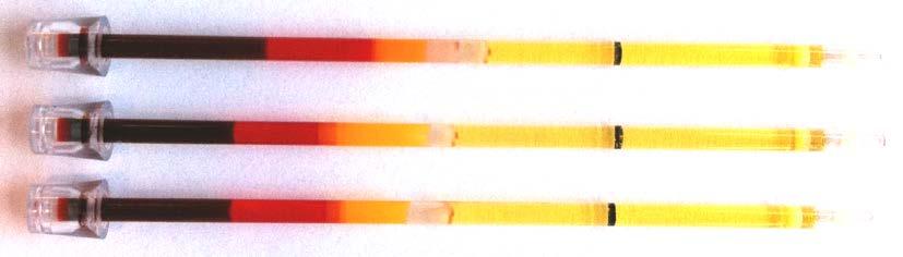 Figur 2. Centrifugerade QBC hematokritrör från tre olika katter. Längst till vänster återfinns erytrocyter (mörkrött och rött område).