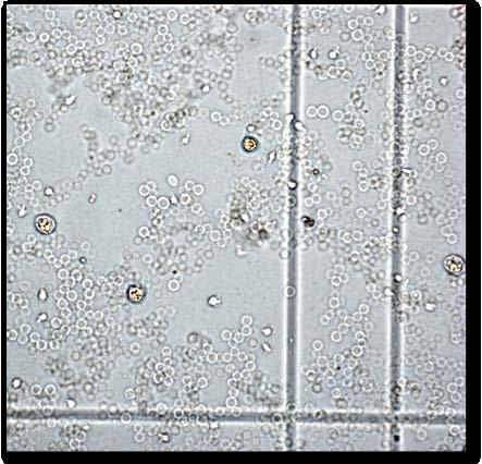 Figur 3. Fotografi av ett synfält från en manuell räknekammare. I förstoringen till vänster syns en stor cell med granulerad kärna (leukocyt).