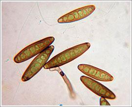 Respirationorganiskt material + syre = CO 2 + H 2 O Mikrosvampar kan dock växa i både aerob som anaerob (syrefattig) miljö.