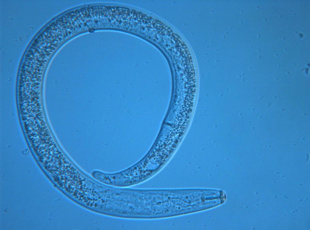 Nematoder Rundmaskar med flercelliga, osegmenterade, cylindrisk