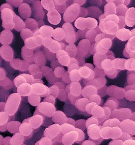 Karies en kostinducerad sjukdom Ekologisk plackhypotes Galactose Maltose Lactose