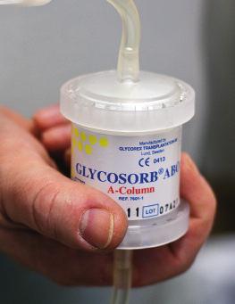 Så används Glycosorb -ABO Företagets huvudprodukt Glycosorb -ABO möjliggör transplantationer över blodgruppsgränserna. Behandlingen med produkten är skonsam och säker.