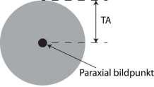 Avvikelser från paraxial approximation => Monokromatiska aberrationer. (Det finns också kromatiska aberrationer som beror på dispersion i linsmaterialet, se föreläsn.