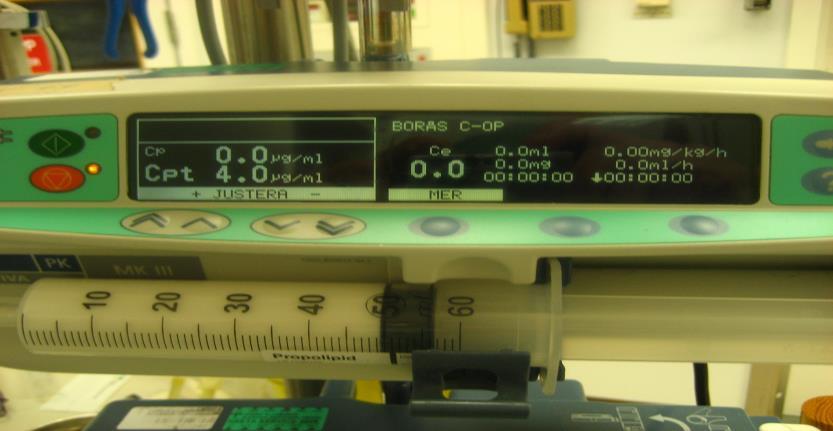 2016-11-28 26353 24 (41) Praktisk TCI-teknik med Propofol och Remifentanil. Läkemedlen monteras i pumparna som programeras med patient data.