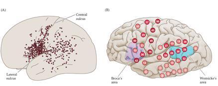 regioner är mer komplex än vad Wernicke och Broca trodde. Vidare är flera av dessa områden kritiska för språk och språkförståelse.