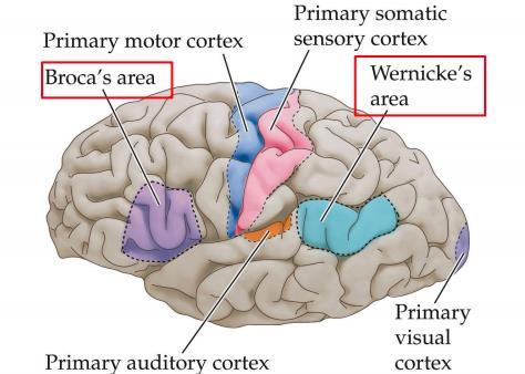 Broca s area är ett område i frontalloben som förknippas med att uttrycka sig i språk där en skada på denna del ger motorisk afasi och man har svårt att få ut orden.