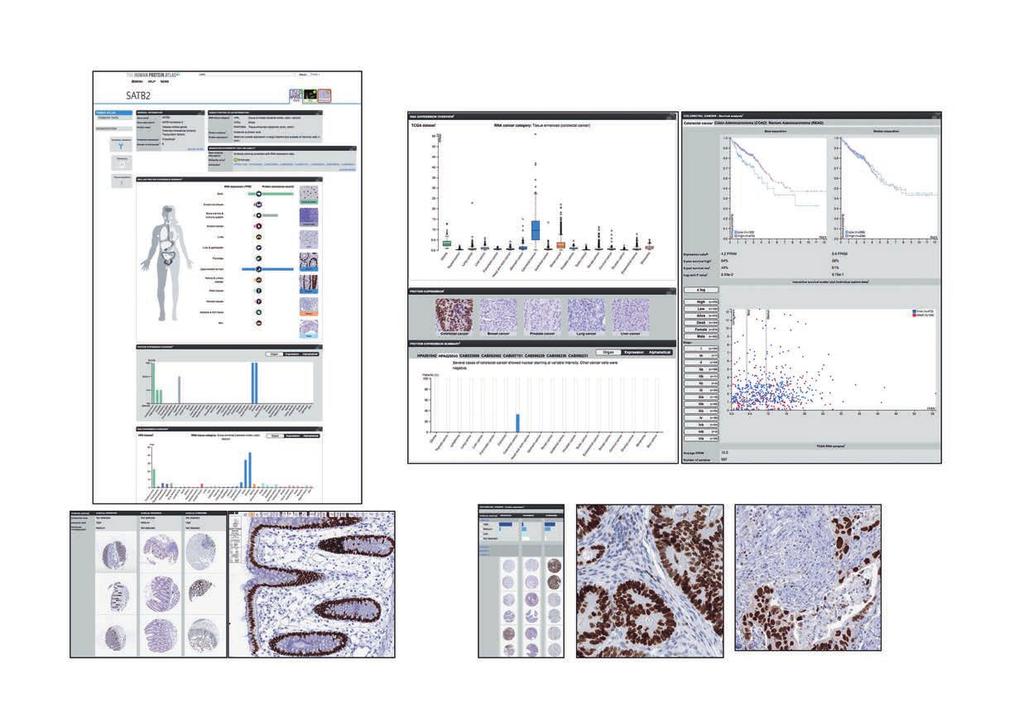 biomedicinska kunskapsbaser Figur 3. Exempel på data för SATB2.