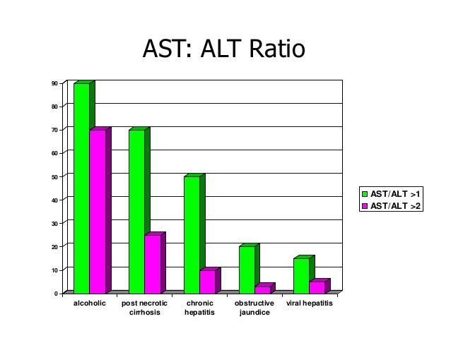 En majoritet av fallen med alkoholhepatit har hög ASAT/ALAT-kvot