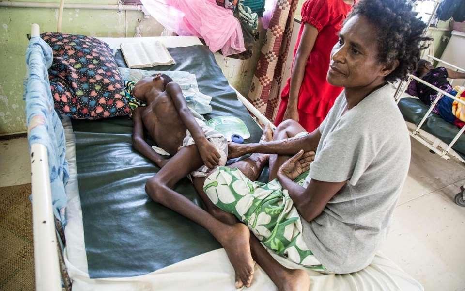Tuberkulos och barnvaccinationsprogram Tuberkulos Ledande dödsorsak bland infektionssjukdomar Vanlig i
