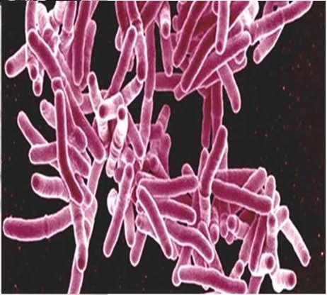 skyddseffekt Ger dock skydd mot allvarliga former av tuberkulos hos små barn Ingår i flertal