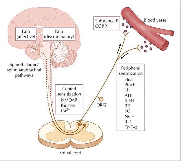 Rodnad inflammation? Inflammatoriska vasodilaterande markörer såsom cyklooxygenas och NO är låga vid vestibulodyni.