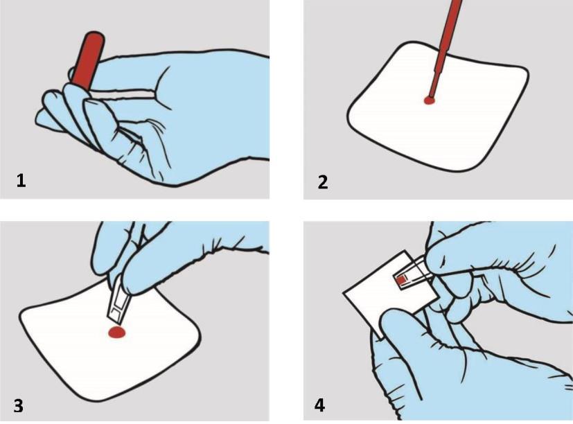 6.2. Venös provtagning Vid förvaring i kylskåp* skall blodet tillåtas anta rumstemperatur före blandning. 1. Blodet måste vara väl blandat före provtagningen.