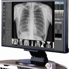 Institutionen för hälsovetenskap Avdelningen för medicinsk vetenskap Studiehandledning M0057H Radiografi med inriktning mot