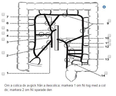 Kirurgisk åtgärd Kirurgisk åtgärd mot primärtumören Kirurgisk åtgärd Åtgärdsdatum --Välj-- Värden i lista Enbart stent Endoskopisk polypektomi (som enda åtgärd) Operation Enbart stomi Orsak --Välj--