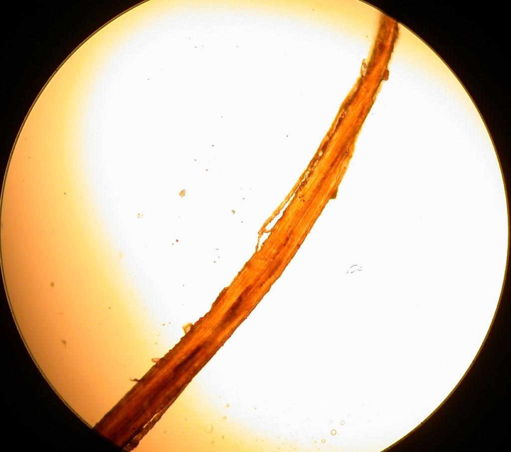 Fiberanalys vantens