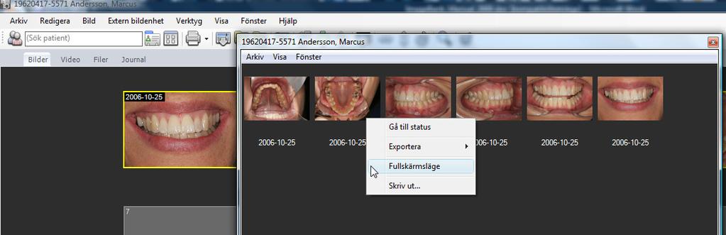 Fönstret öppnas ovanpå ImageBank och kan ställas in i passande storlek. Patientens samtliga bilder finns för åtkomst.