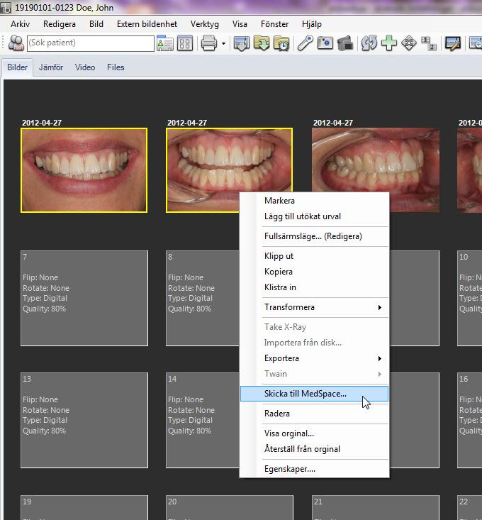 ImageBank har en webbaserad e-postklient (utvecklad av teamet bakom ImageBank) som SSL-krypterar all kommunikation via e-post (patientdatalagen). Programmet heter MedSpace (exempel nedan).