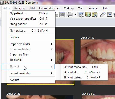 SKRIVA UT BILDER Det går att skriva ut bilder på tre olika sätt i ImageBank. Skriv ut markerat, Skriv ut allt och Skriv ut status. 1. "Skriv ut markerat". Markera den/de bilder man vill skriva ut. 2.