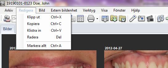 Senast använda. Listar de senast aktiva patienterna för snabb access. Avsluta. Stänger ImageBank. REDIGERA Klipp ut. Klipper ut t ex en bild i ett status för att senare kunna Klistras in Kopiera.