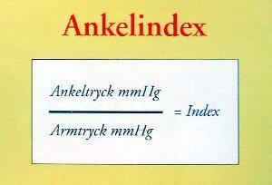 Utförande Patienten undersöks bäst liggande. En blodtrycksmanschett sättes över smalbenet. Applicera en klick gel i området där du tänker leta efter kärlet.