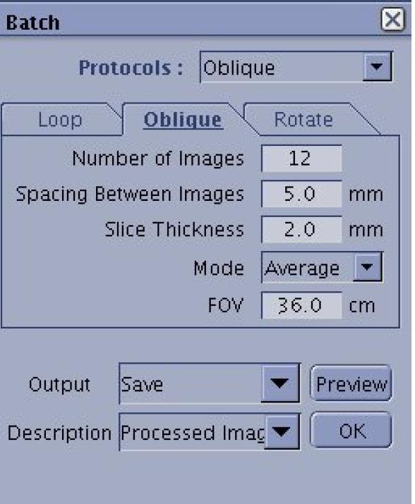 0 När batch-rutan öppnats klicka på Oblique för att få upp boxen med streck på den korrigerade sagitella oblique-bilden.