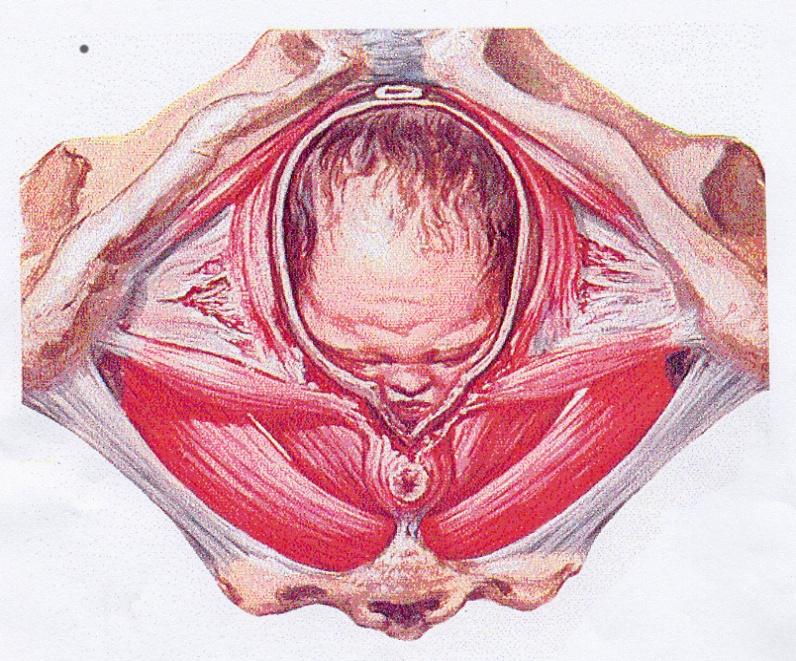 Vaginal förlossning och risken att utveckla urininkontinens och prolaps Antal vaginala