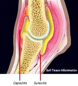 Lundeberg. Smärta och inflammation Levine et al. Neurogenic inflammation and arthritis.