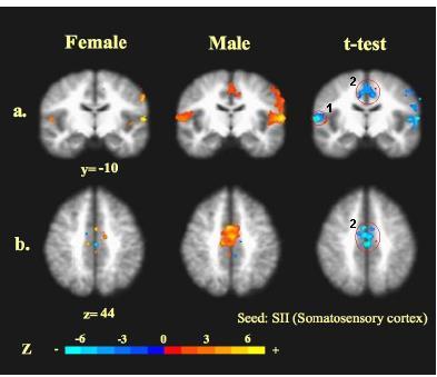 Brain Research 2010;1362:56-67.