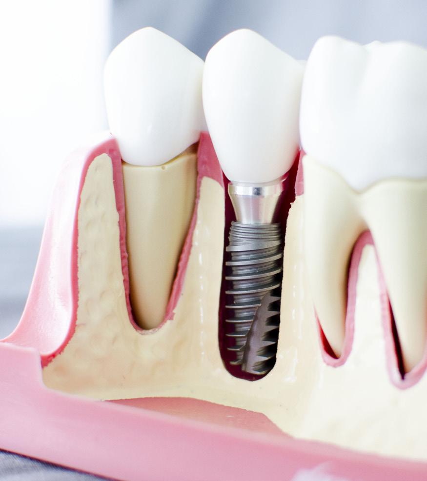 GRUNDLÄGGANDE IMPLANTATKURS IMPLANTATBEHANDLING I TEORI OCH PRAKTIK.