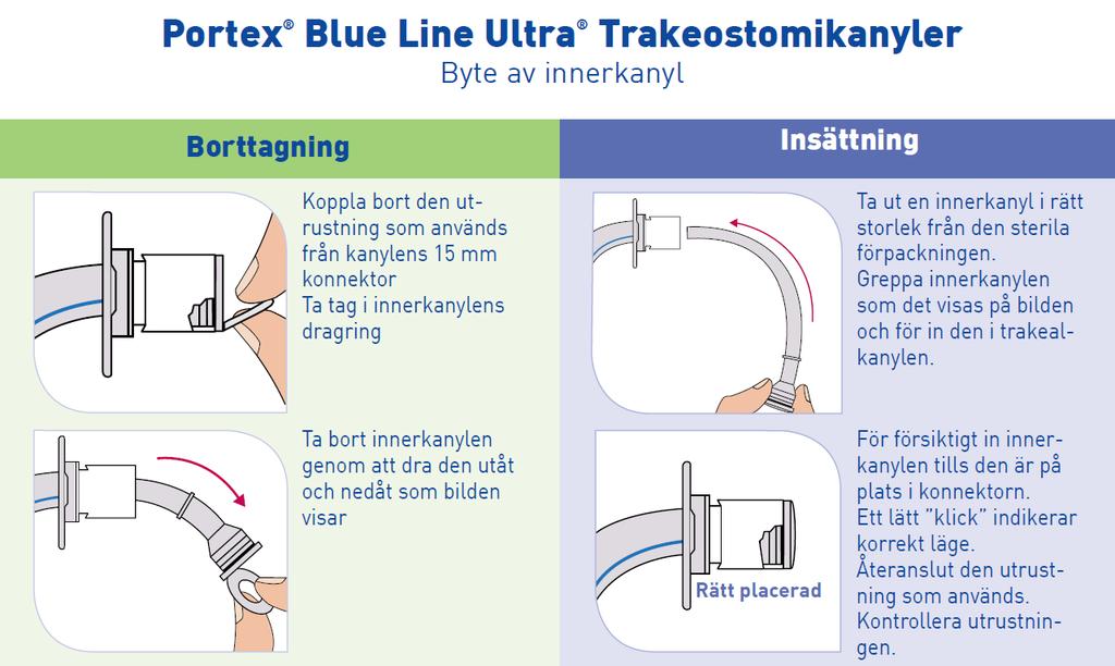Rengöring av innerkanyl Patienter på vårdavdelning: Rengöring av innerkanyl utförs minst två gånger per dygn samt vid behov. Använd om möjligt extra innerkanyl medan den ordinarie rengörs.
