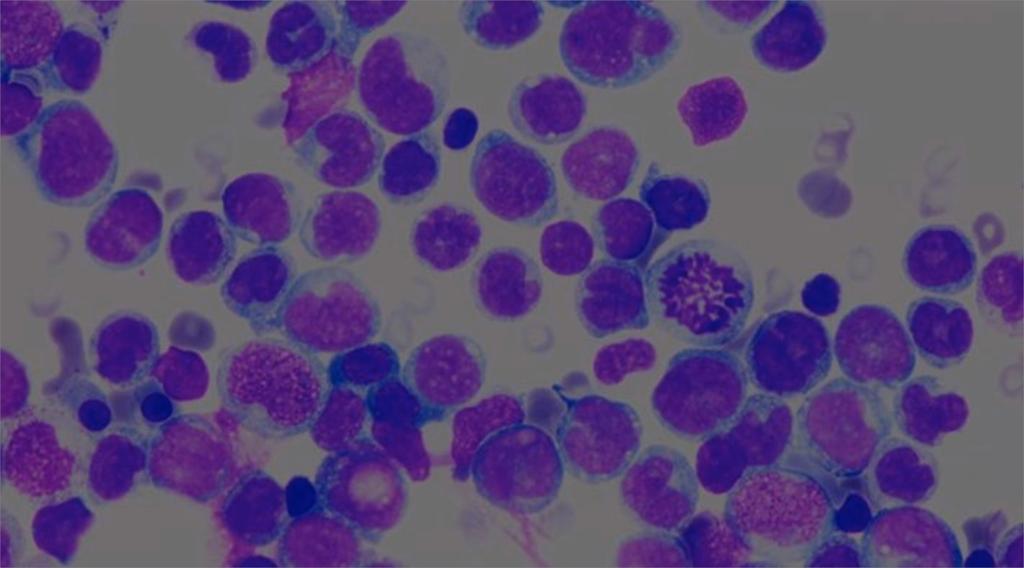 Pandemier Antimikrobiell resistens Gemensamma