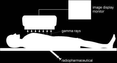 Gammastrålande radionuklid (t.