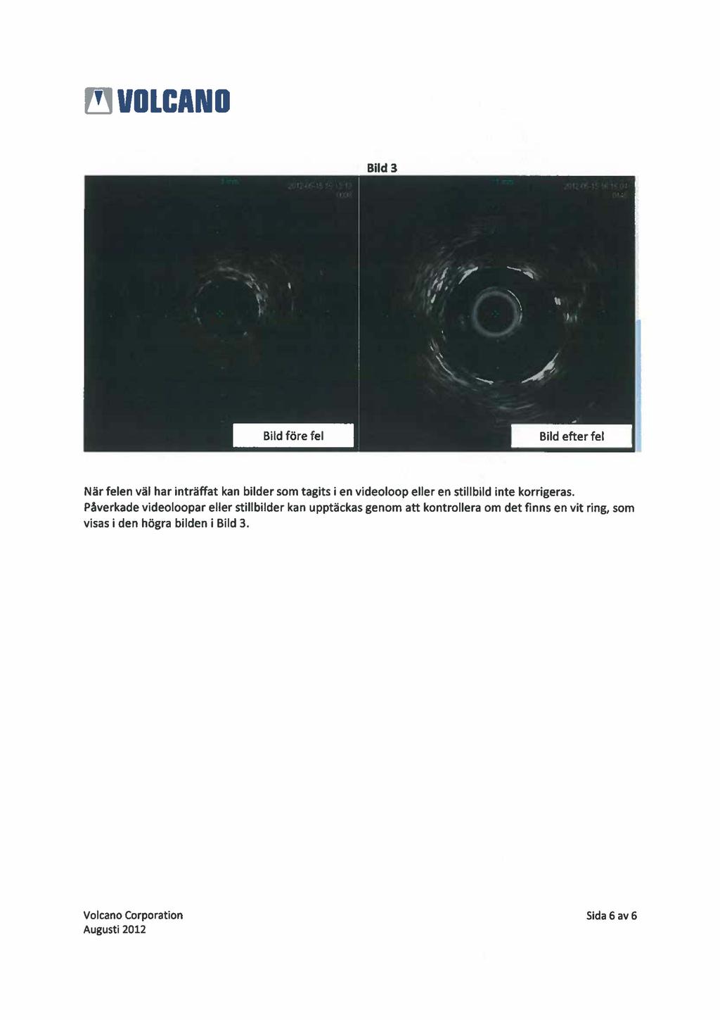 Bild 3 När felen väl har inträffat kan bilder som tagits i en videoloop eller en stillbild inte korrigeras.
