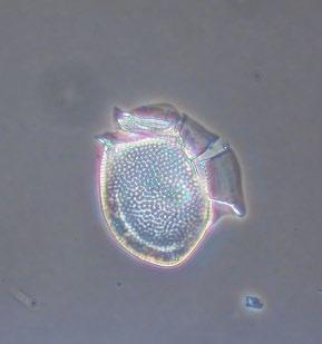 FIGUR. Den potentiellt giftiga kiselagen Pseudo-nitzschia. FIGUR. Dinoflagellaten Ceratium tripos. förhållandevis stora mängder av olika kiselalger, t.ex.