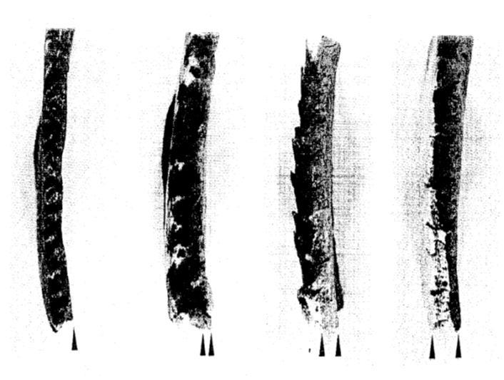 Figur 1. Graden av synostos hos fyra individer av känd ålder, Holck 1986. 27 år (vänster), 35 år, 58 år och 85 år (höger). Tabell 2. Kraniets synostos enligt Gejvall (1948).
