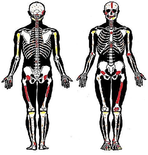 Grav 97 Vikt (gram) Frag. antal Kranium (totalt) 75,18 91 Viceralkranium 7,29 5 Neurokranium 13,65 6 Dentes 2,17 14 Övrigt (obestämt) 52,07 66 Ryggrad (totalt) 11,74 18 Cervicales 4,16 7 Bilaga 3.