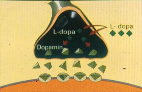 1. L-Dopa i olika beredningsformer L-dopa Madopark L-dopa/benzerasid