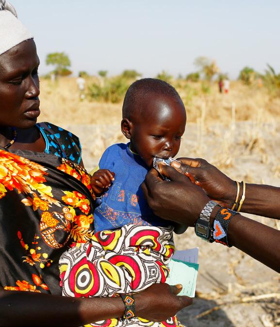 UNICEF/Modola UNICEF behandlar barn mot undernäring i Sydsudan Nyalel Gatcauk, två år, lider av undernäring. Här får hon näringsrik nötkräm av UNICEFs personal på plats i Sydsudan.