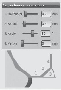 ANVÄNDNING Kantparametrar i CAD-programmet Vid Ceramill Zolid Preshades bör man se till att kanterna är tillräckligt tjocka. Rekommenderade värden: _ 1. Kanttjocklek (Horizontal): 0,2 mm _ 2.