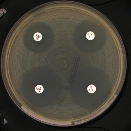 h vs 1 h incubation