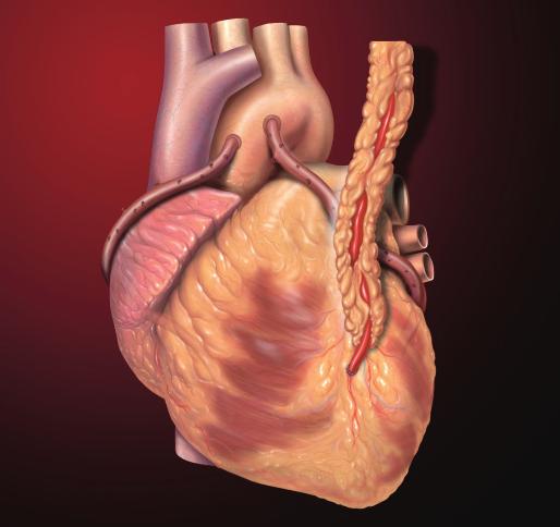 Sukhi Singh In Sweden, 5,809 cardiac operations were performed in 2017 and 3,285 operations were CABG alone or combined with other cardiac interventions. The thirty-day mortality rate was 1.8% [12].