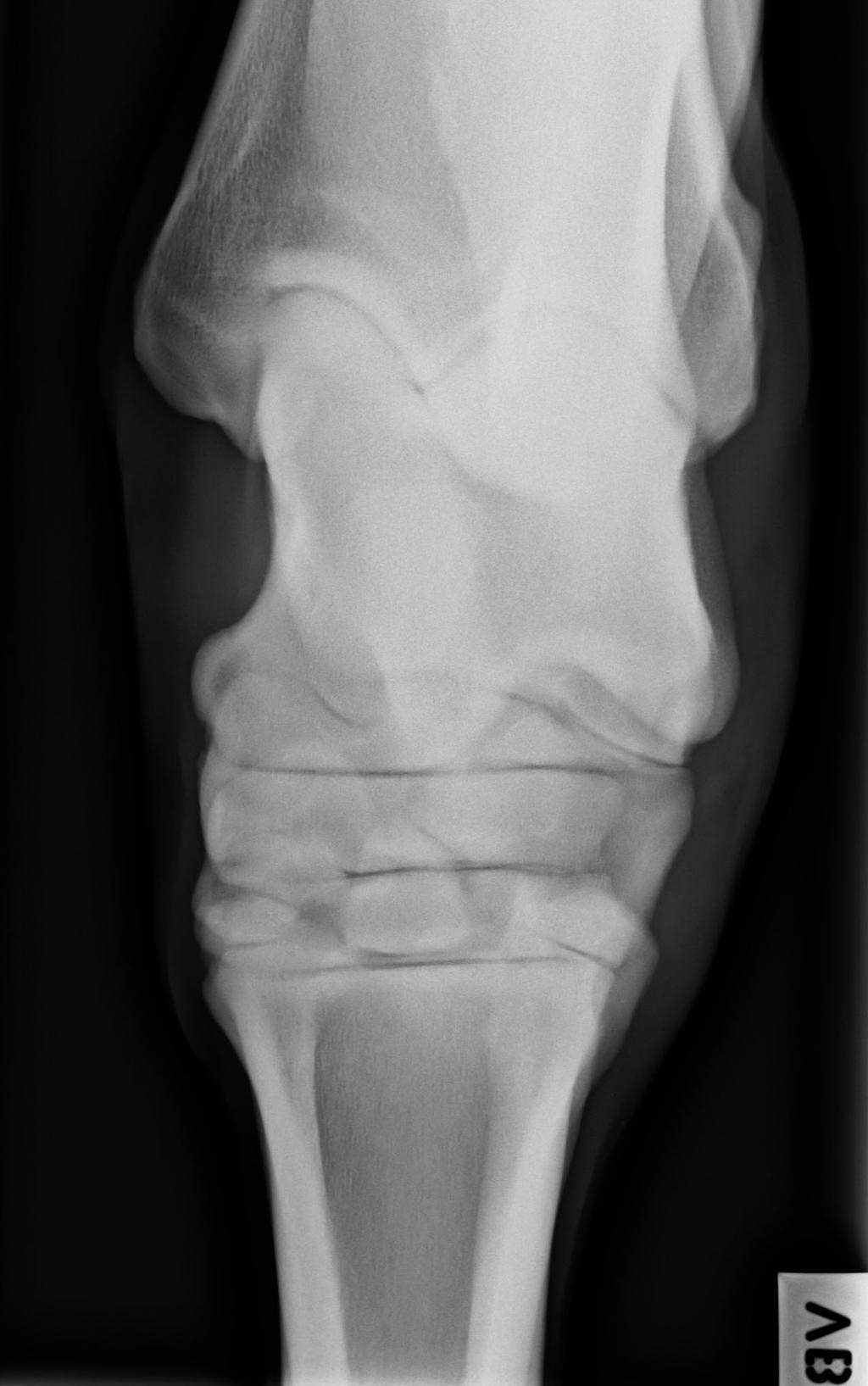 Transversal STIR (Fig 4).