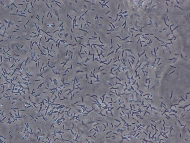 Laktobacill-miljö De flesta kvinnor i reproduktiv ålder har dominans av någon av 4 lactobaciller: L iners, L crispatus, L gasseri, L Jenseri Producerar