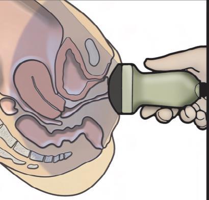 Midsagittal view.