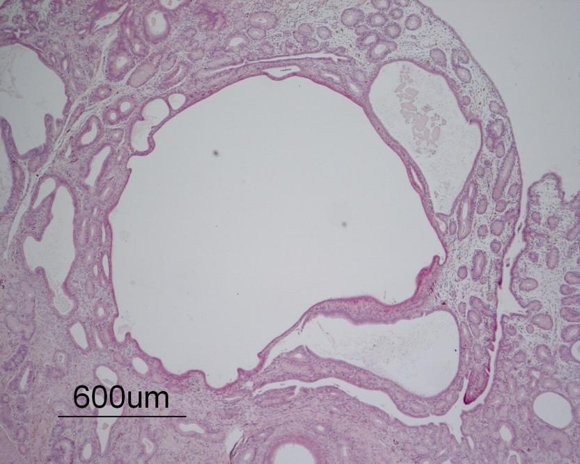 Uterus endometrium blir förtjockat (Cox, 1970; Gilbert, 1992) och får cystiskt dilaterade och ökat antal körtlar (Gilbert, 1992; Schlafer & Foster, 2016).