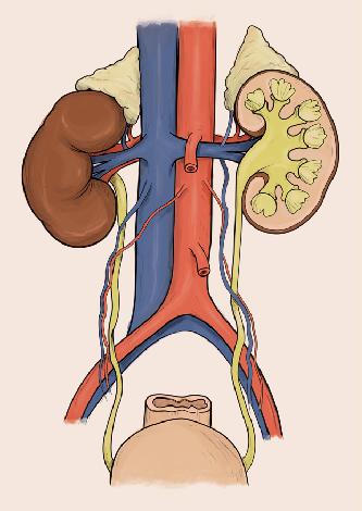 Hålven (vena cava) Kroppspulsåder (aorta) Höger binjure Höger njure