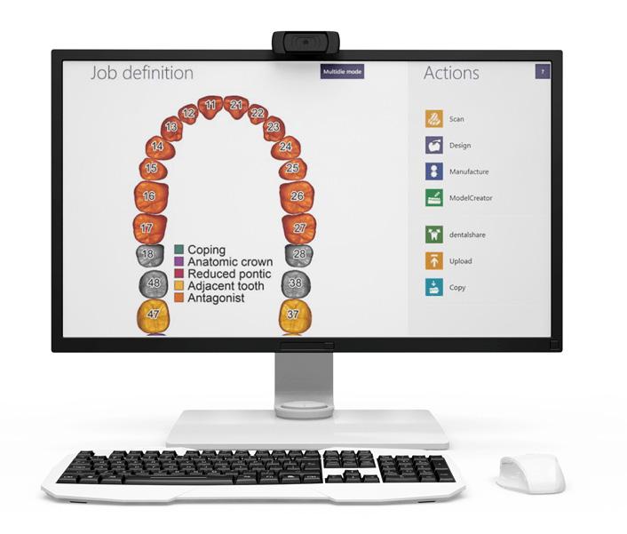 OpenMill Lite bättre på digital tandvård! OpenMill är en svensk CAD/CAMproduktion av kronor, broar, modeller och implantatprotetik.